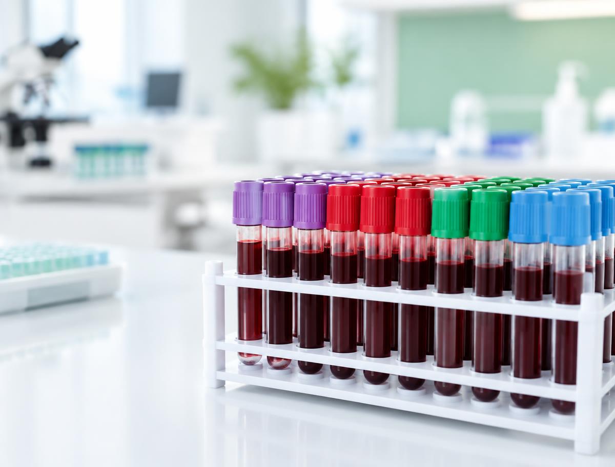 Blood Tests